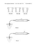 TREATMENT TIP INCISION TEMPLATE diagram and image