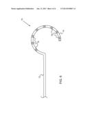 CATHETER WITH HELICAL ELECTRODE diagram and image