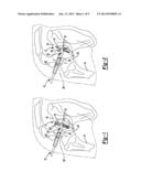 GLENOID REAMER diagram and image