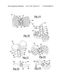 GLENOID REAMER diagram and image