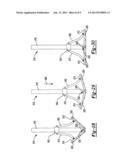 GLENOID REAMER diagram and image