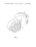 KNOTLESS GRAFT FIXATION USING AN IMPLANT HAVING A POINTED TIP diagram and image