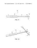 KNOTLESS GRAFT FIXATION USING AN IMPLANT HAVING A POINTED TIP diagram and image