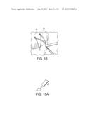 KNOTLESS GRAFT FIXATION USING AN IMPLANT HAVING A POINTED TIP diagram and image