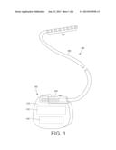 IMPLANTABLE SYSTEM WITH IMPROVED RF TOLERANCE diagram and image