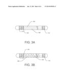 IMPLANTABLE SYSTEM WITH IMPROVED RF TOLERANCE diagram and image