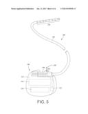 IMPLANTABLE SYSTEM WITH IMPROVED RF TOLERANCE diagram and image