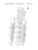 Conductive Coil Arrangement and Electrode Catheter Arrangement, in     Particular for Cardiac Therapy diagram and image