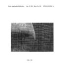 SCAFFOLD SYSTEM TO REPAIR CARDIOVASCULAR CONDITIONS diagram and image