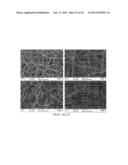 SCAFFOLD SYSTEM TO REPAIR CARDIOVASCULAR CONDITIONS diagram and image