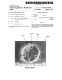 DECALCIFYING HEART VALVE diagram and image