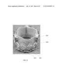 DECALCIFYING HEART VALVE diagram and image