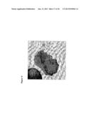 BIODEGRADABLE POLYURETHANE/UREA COMPOSITIONS diagram and image