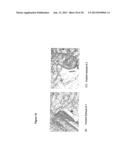 BIODEGRADABLE POLYURETHANE/UREA COMPOSITIONS diagram and image