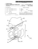 BONE IMPLANT diagram and image