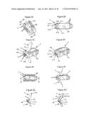 Anchoring Device and System for an Intervertebral Implant, Intervertebral     Implant and Implantation Instrument diagram and image