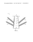 Implant with Sensor diagram and image