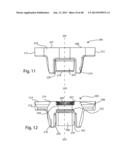 GLENOID VAULT FIXATION diagram and image