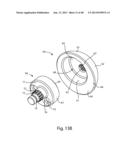 GLENOID VAULT FIXATION diagram and image