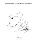 GLENOID VAULT FIXATION diagram and image