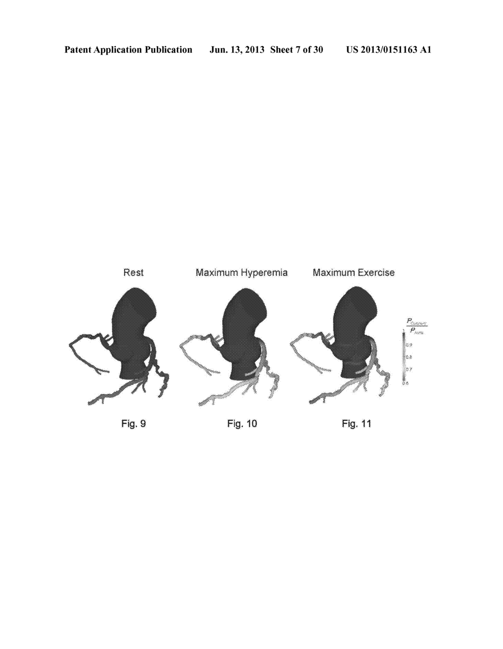 METHOD AND SYSTEM FOR PATIENT-SPECIFIC MODELING OF BLOOD FLOW - diagram, schematic, and image 08