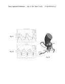 METHOD AND SYSTEM FOR PATIENT-SPECIFIC MODELING OF BLOOD FLOW diagram and image