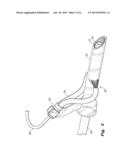 SELF-CLEANING AND STERILIZING MEDICAL TUBE diagram and image