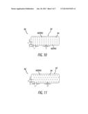 DUAL ANODIZATION SURFACE TREATMENT diagram and image