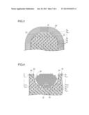 STATOR diagram and image