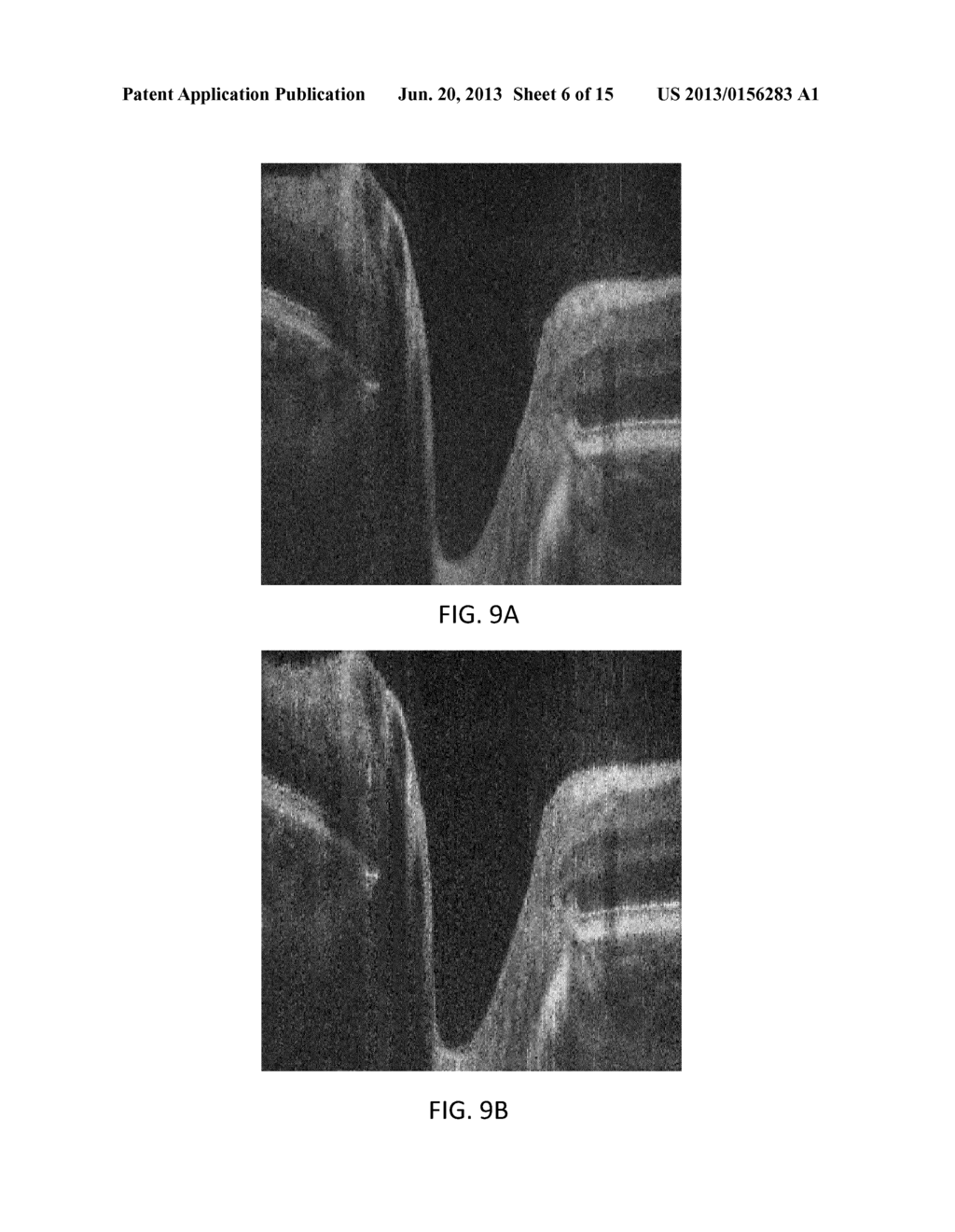 SYSTEM AND METHOD FOR RAPID OCT IMAGE ACQUISITION USING COMPRESSIVE     SAMPLING - diagram, schematic, and image 07