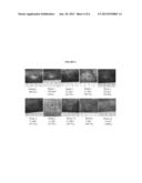 METHODS OF PREPARING CHORION TISSUE AND PRODUCTS DERIVED THEREFROM diagram and image