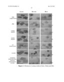 METHODS OF PREPARING CHORION TISSUE AND PRODUCTS DERIVED THEREFROM diagram and image