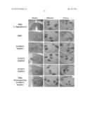 METHODS OF PREPARING CHORION TISSUE AND PRODUCTS DERIVED THEREFROM diagram and image