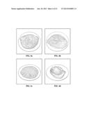 Processing of Whole or Portions of Genus Musa and Related Species diagram and image