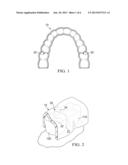 APPARATUS FOR ORTHODONTIC ALIGNER TRAY RETENTION diagram and image