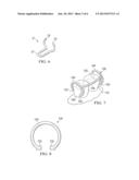 APPARATUS FOR ORTHODONTIC ALIGNER TRAY RETENTION diagram and image