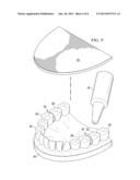 APPARATUS FOR ORTHODONTIC ALIGNER TRAY RETENTION diagram and image