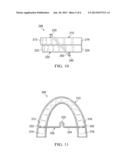 APPARATUS FOR ORTHODONTIC ALIGNER TRAY RETENTION diagram and image