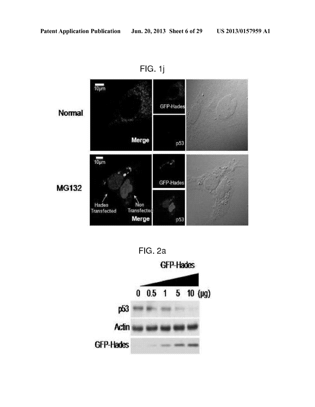 USE OF HADES AS TUMOR SUPPRESSOR TARGET - diagram, schematic, and image 07