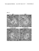 VECTORS AND SEQUENCES FOR THE TREATMENT OF DISEASES diagram and image