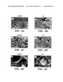 SILK FIBROIN MATERIALS AND USE THEREOF diagram and image