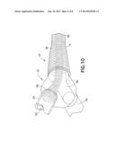 Dual Lumen Cannula diagram and image