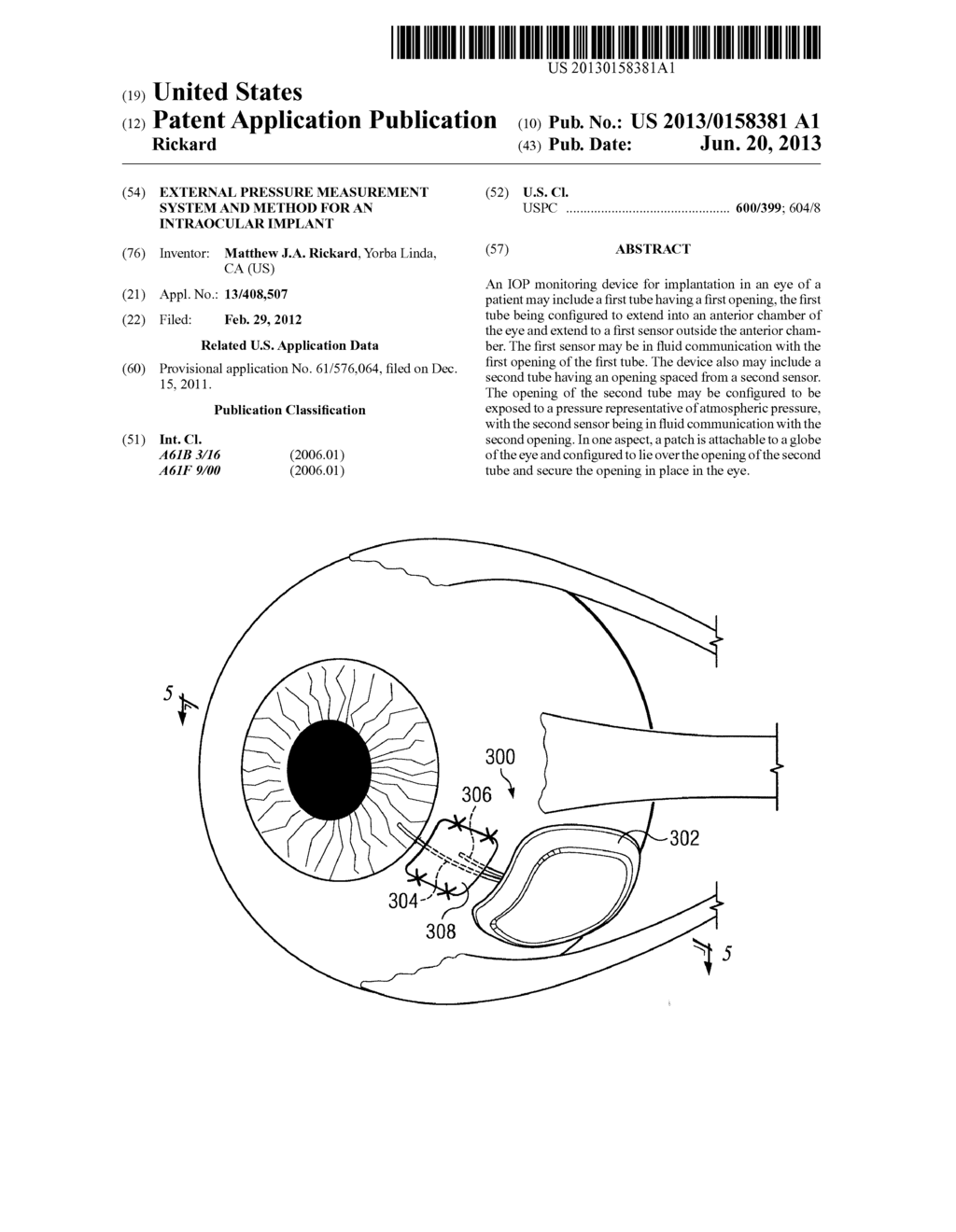 External Pressure Measurement System and Method for an Intraocular Implant - diagram, schematic, and image 01