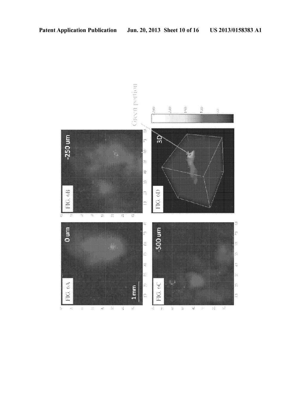 BOND-SELECTIVE VIBRATIONAL PHOTOACOUSTIC IMAGING SYSTEM AND METHOD - diagram, schematic, and image 11