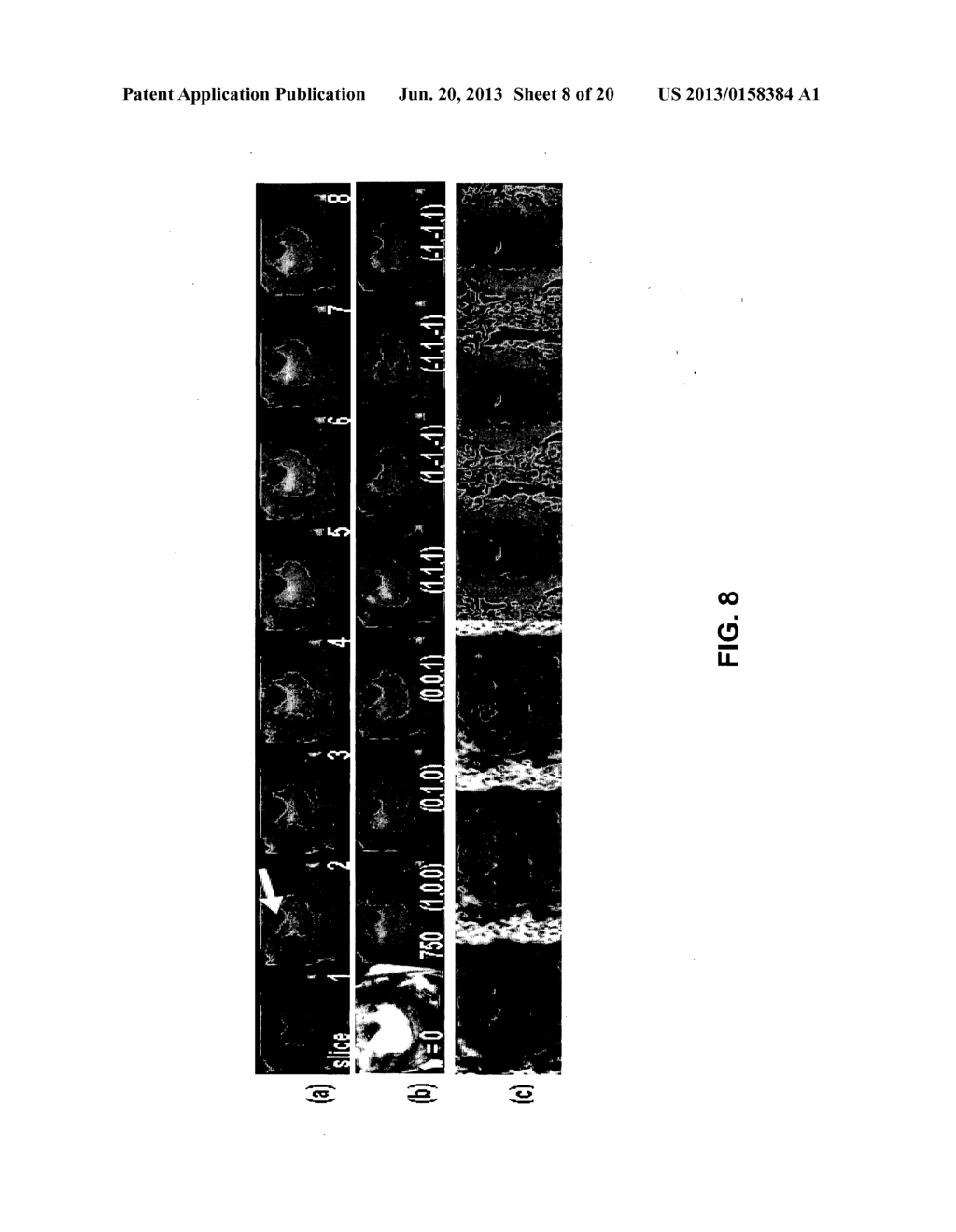 Systems and Methods for Magnetic Resonance Imaging - diagram, schematic, and image 09