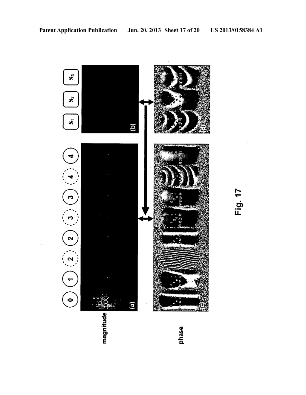 Systems and Methods for Magnetic Resonance Imaging - diagram, schematic, and image 18