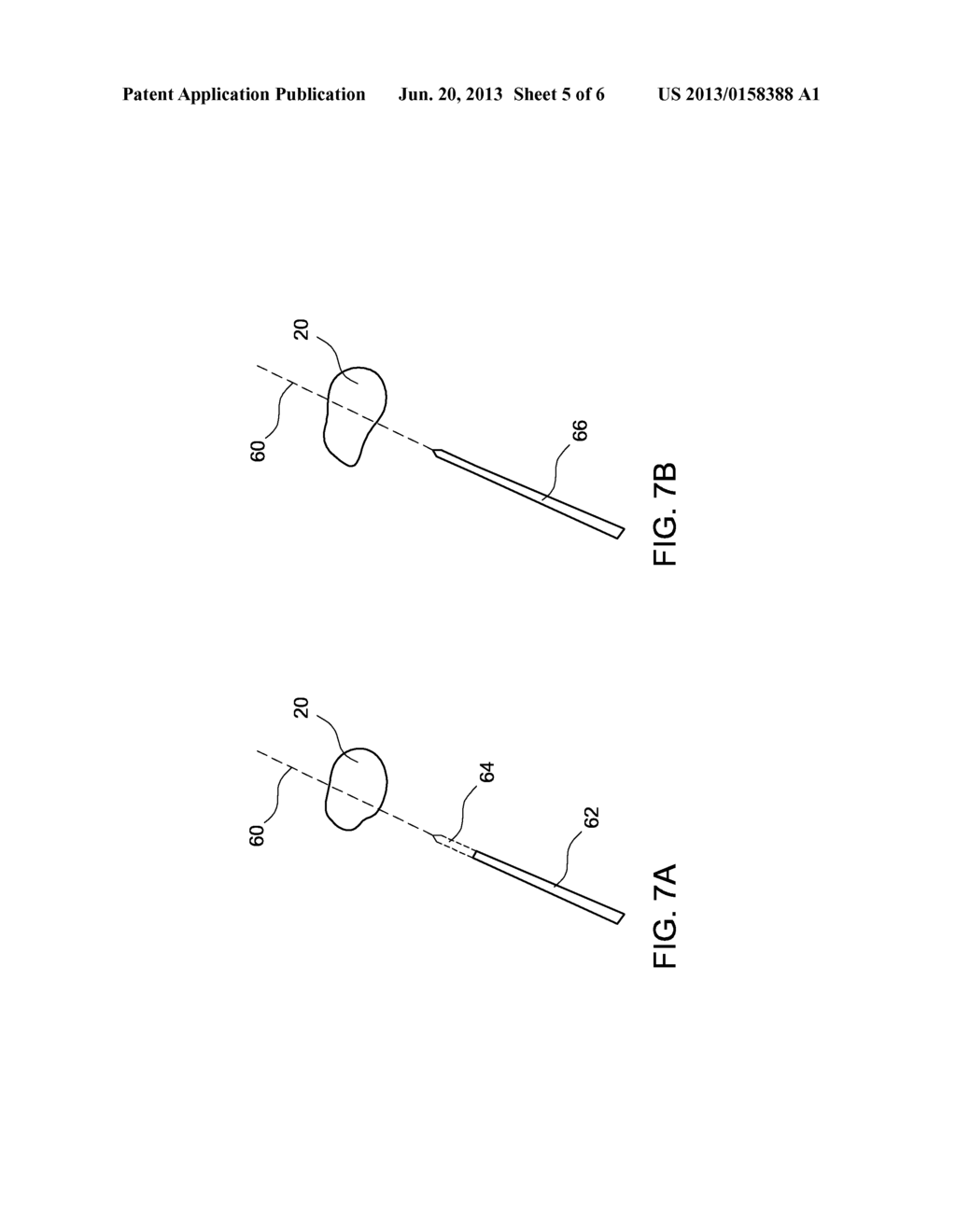 NEEDLE GUIDANCE FOR MOLECULAR IMAGING - diagram, schematic, and image 06