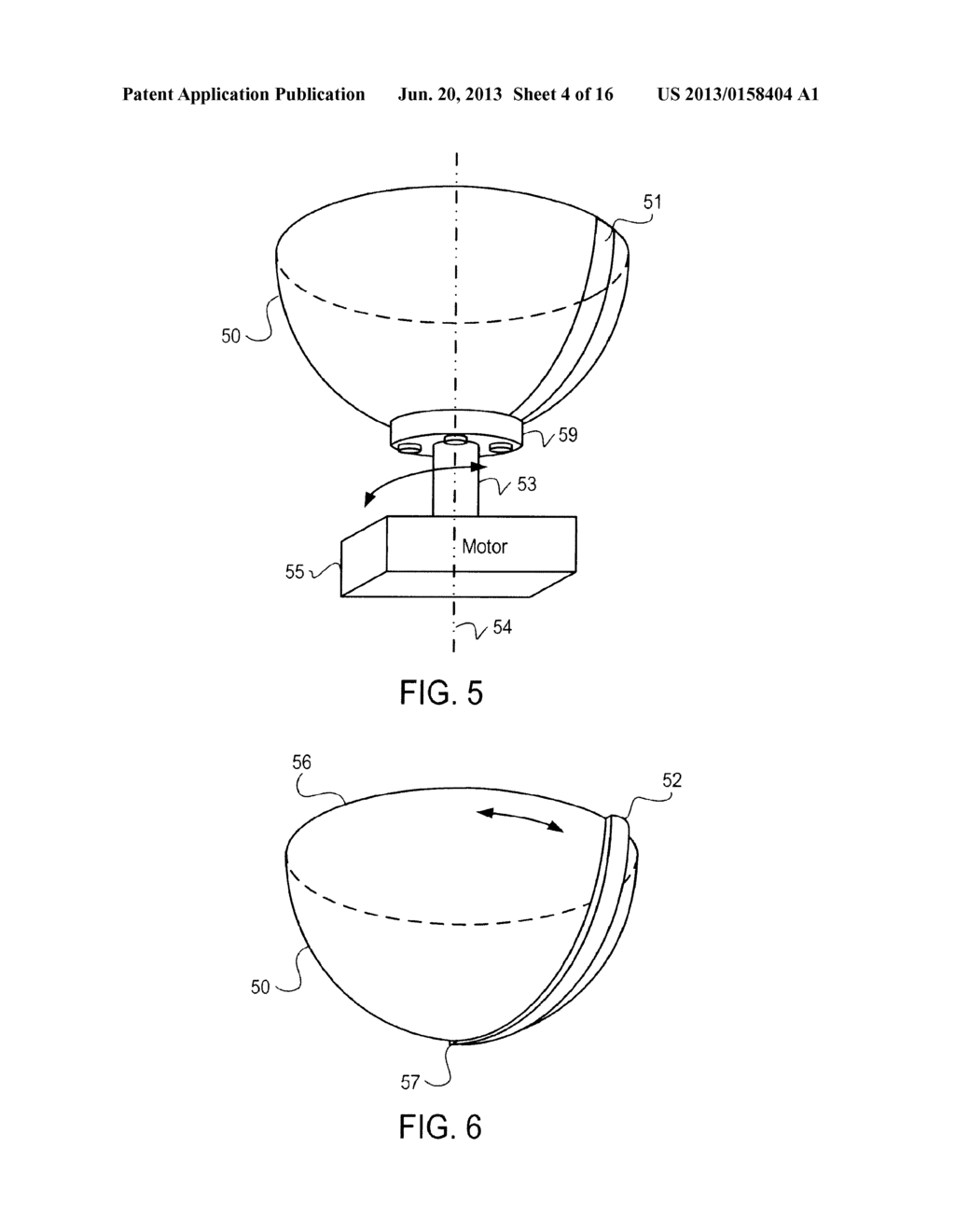 SYSTEM AND METHOD FOR THREE-DIMENSIONAL ULTRASOUND IMAGING - diagram, schematic, and image 05