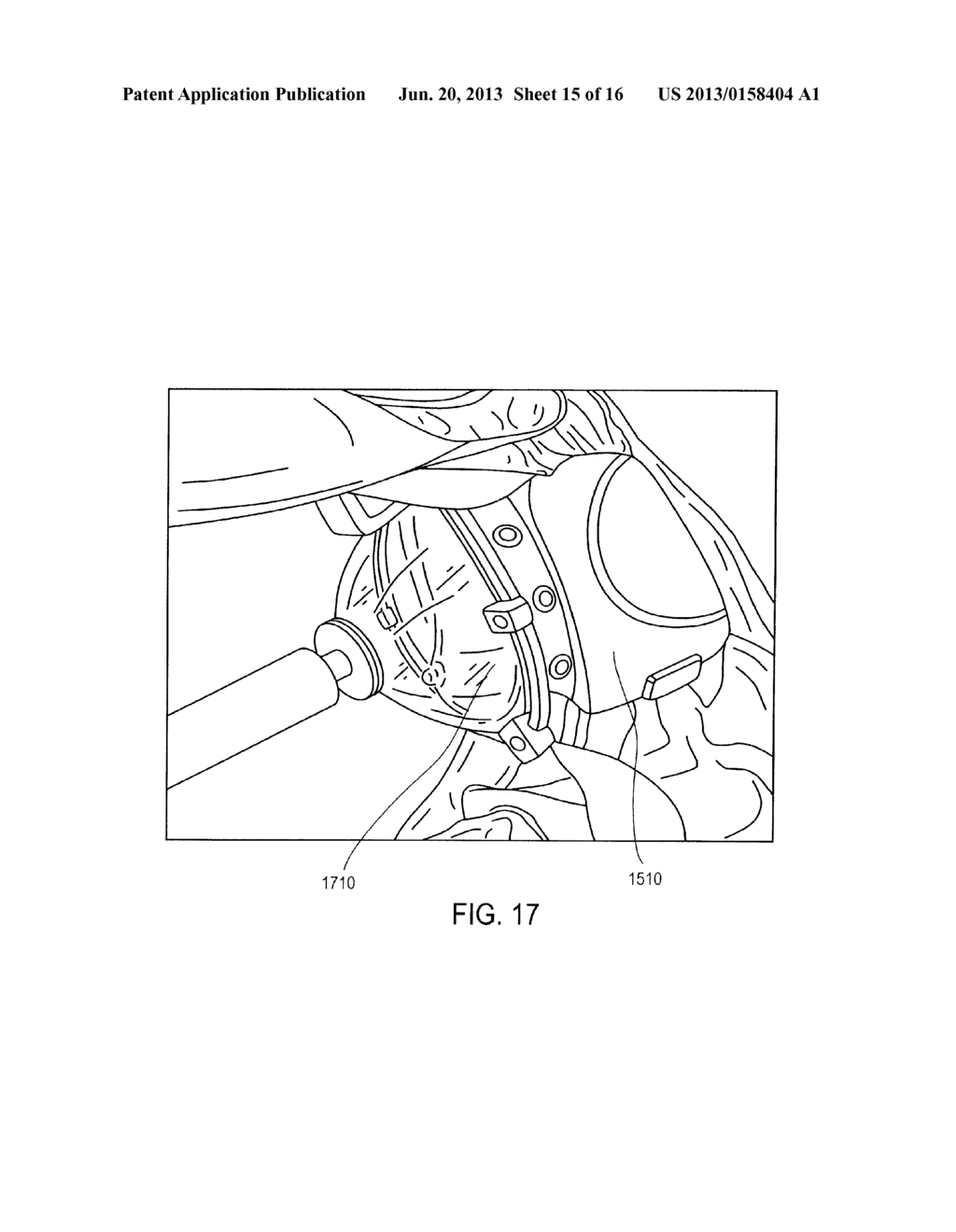 SYSTEM AND METHOD FOR THREE-DIMENSIONAL ULTRASOUND IMAGING - diagram, schematic, and image 16