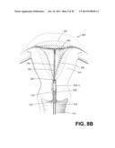 METHODS AND SYSTEMS FOR EVALUATING THE INTEGRITY OF A UTERINE CAVITY diagram and image